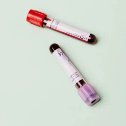 Blood test sample tubes used for laboratory work during USCIS Immigration Medical Exams at Weston Medical Clinic in Weston, Florida.